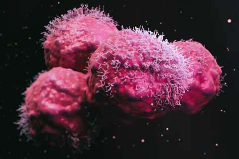 Cancers Ramp Up Overall mRNA Expression as They Progress