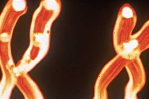 Many Men Lose Y Chromosomes as They Age. Now We May Know Why It’s So Deadly