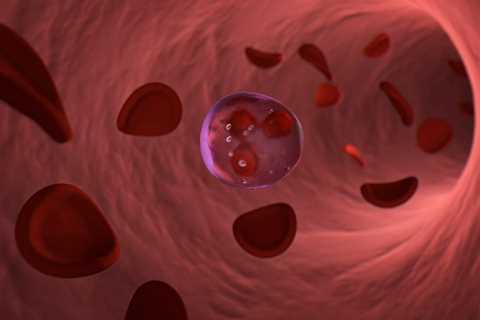 Missing Y Chromosome in Mouse Blood Causes Heart Dysfunction