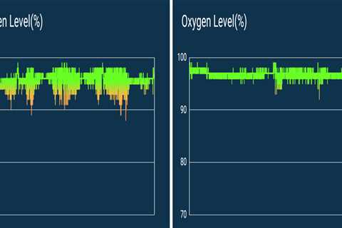 Extreme Sleep Apnea Prognosis Panics Reporter Till He Finds a Easy, No-Value Answer